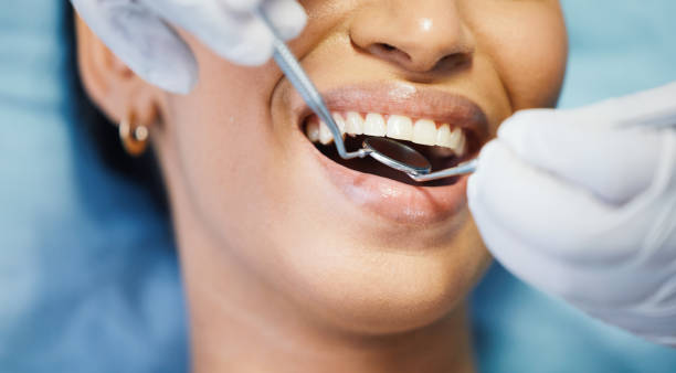 Best Knocked-Out Tooth Emergency  in Golf Manor, OH