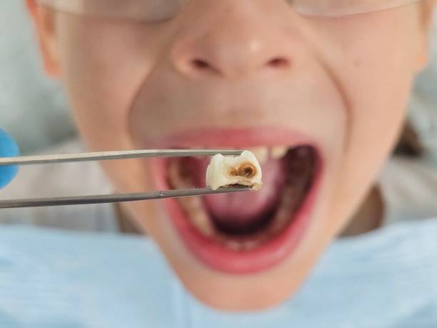 Best Cracked Tooth Emergency Dentist  in Golf Manor, OH